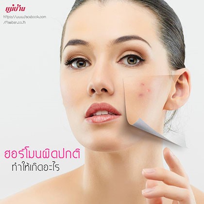 ฮอร์โมนผิดปกติ ทำให้เกิดอะไร สำนักพิมพ์แม่บ้าน