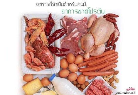 อาหารจำเป็น สำหรับคนมีอาการขาดโปรตีน สำนักพิมพ์แม่บ้าน